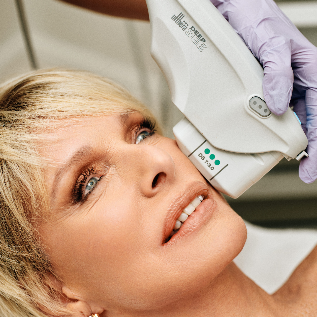 1 Ultherapy Lower Face