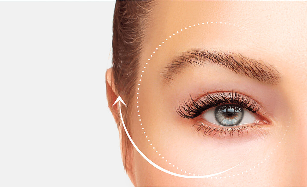 Eye Lift with Ultherapy